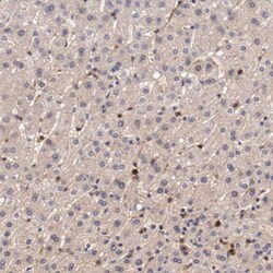 Galectin-1 Antibody, Novus Biologicals:Antibodies:Primary Antibodies